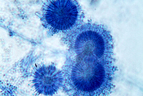 Structure de moisissures Aspergillus spp : observation sous microscope optique (x 400)