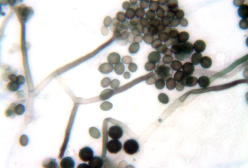 Structure de moisissures Stachybotrys spp : observation au microscope optique (x 400)